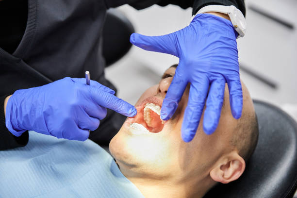 Best Emergency Dental Care for Broken or Chipped Teeth in Graham, NC