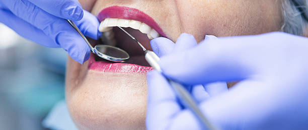Best Emergency Dental Care for Broken or Chipped Teeth in Graham, NC